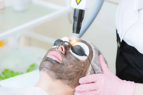 Close-up carbon face peeling procedure. Laser pulses clean skin of the face. Hardware cosmetology treatment. Process of photothermolysis, warming the skin, laser carbon peeling. Facial skin — Stock Photo, Image