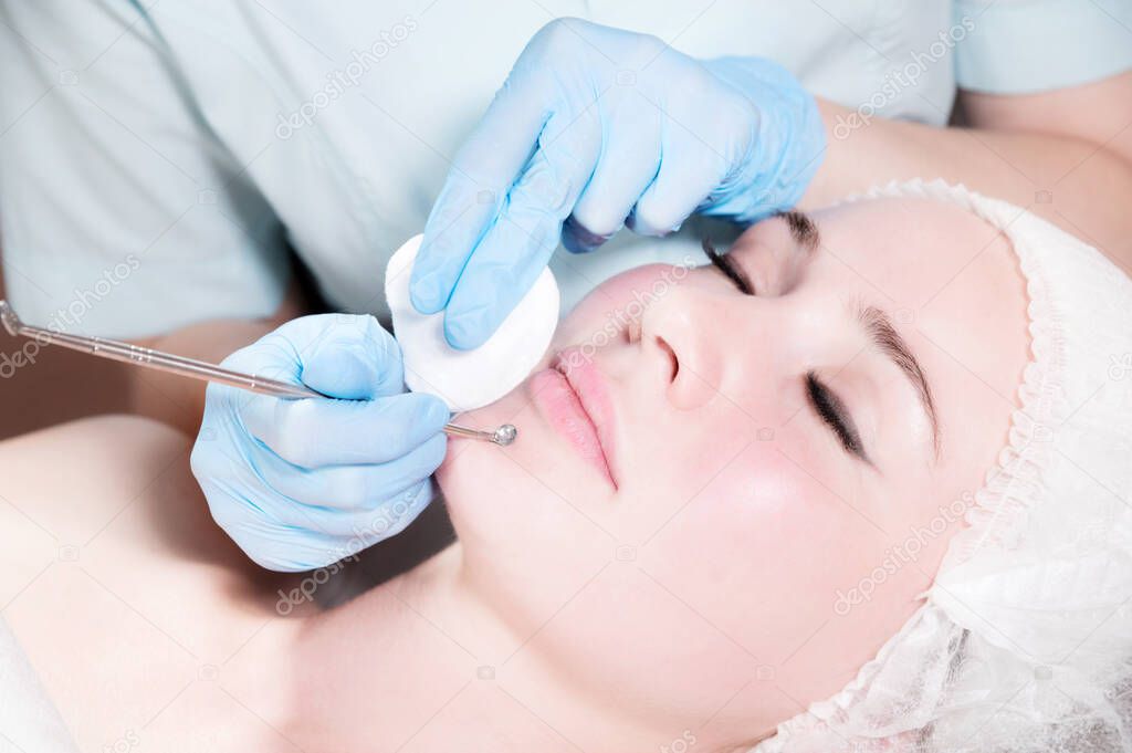 Close-up Mechanical face peel at the beautician. Beautician squeezes acne on the patients forehead with a medical needle. Face next to hands in blue gloves of cosmologist