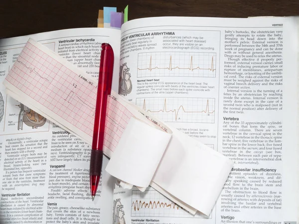Electrocardiogram (ECG) , pen and note — Stock Photo, Image