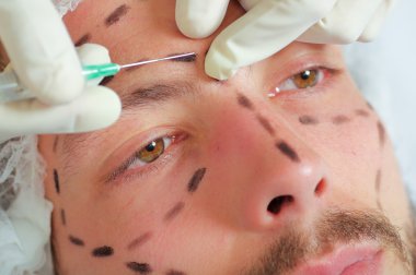 Portre genç yüzü, siyah çizgiler, çizilmiş yüz kozmetik tedavi enjeksiyonları, doktorlar el eldiven tutarak şırınga alma mans