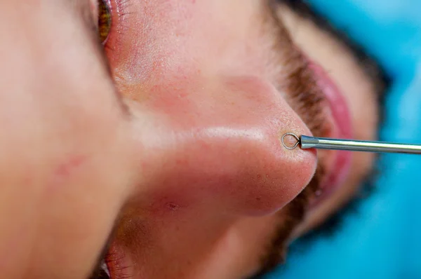 Primeros planos de la cara de los hombres jóvenes que se preparan para el tratamiento cosmético facial, el médico utiliza una herramienta de metal con bucle al final para medir las características de los pacientes —  Fotos de Stock