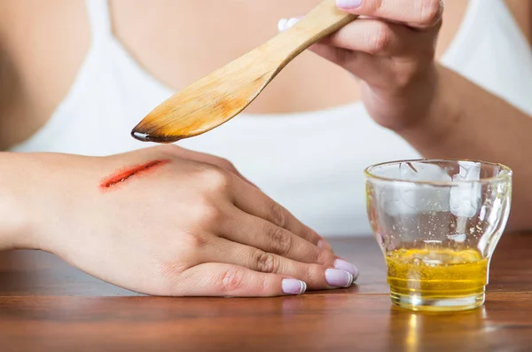 Young model sitting down using wooden knife applying honey to bloody scar on hand — Stock Photo, Image