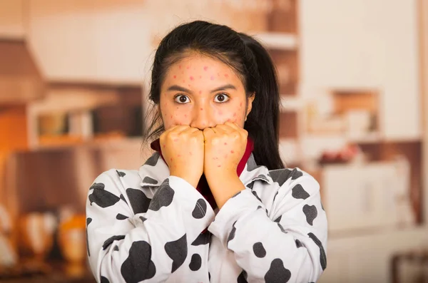 Retrato de chica joven con problemas de la piel gettin ansioso — Foto de Stock