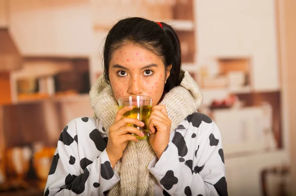 Portrait de jeune fille avec problème de peau buvant une tasse de te avec une serviette grise autour du cou — Photo