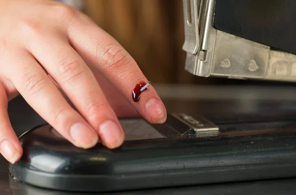 Primo piano di una giovane donna ferita al dito con una cucitrice, sanguinante — Foto Stock