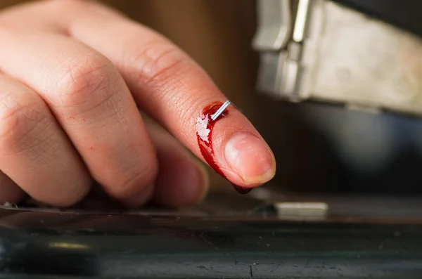 Primo piano di una giovane donna ferita al dito con una cucitrice, sanguinante — Foto Stock