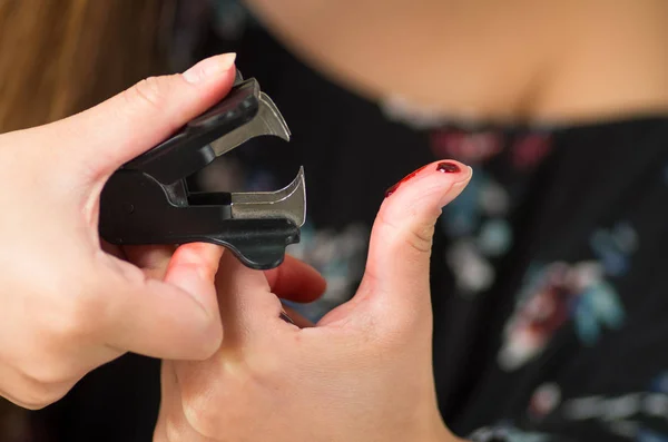 Close up de uma mulher ferido o dedo usando um puxador de grampo preto — Fotografia de Stock