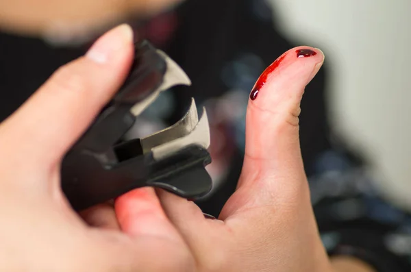 El primer plano de una mujer se lesionó el dedo usando un extractor de grapas negro —  Fotos de Stock