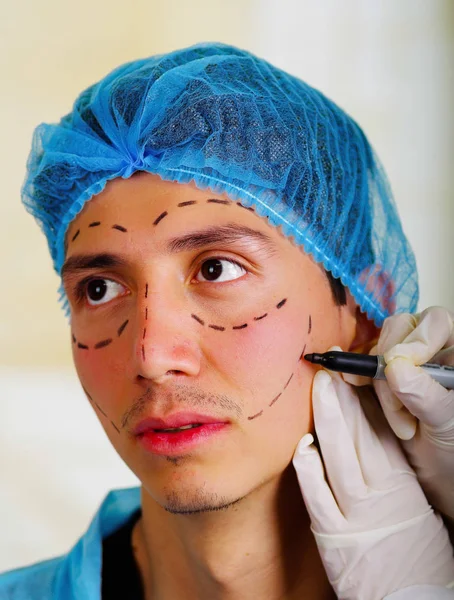 Primer plano de un cirujano dibujando marcas en la cara masculina. Concepto de cirugía plástica — Foto de Stock