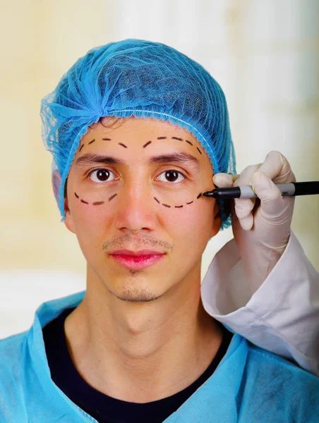 Marcas de desenho de cirurgião no rosto masculino. Conceito de cirurgia plástica — Fotografia de Stock