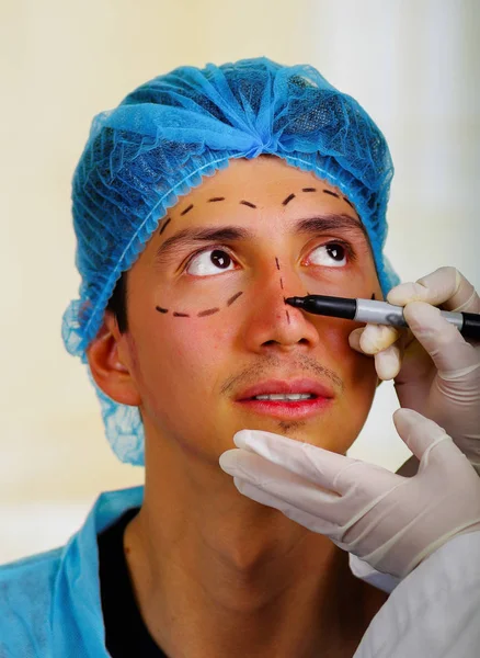 Primer plano de un cirujano dibujando marcas en la cara masculina. Concepto de cirugía plástica —  Fotos de Stock