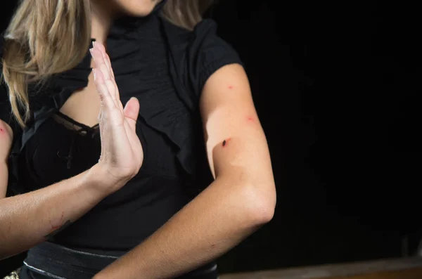 Gros plan d'une jeune femme qui souffre de démangeaisons après une piqûre de moustique. Dermatologie, concept de traitement allergique de la peau . — Photo