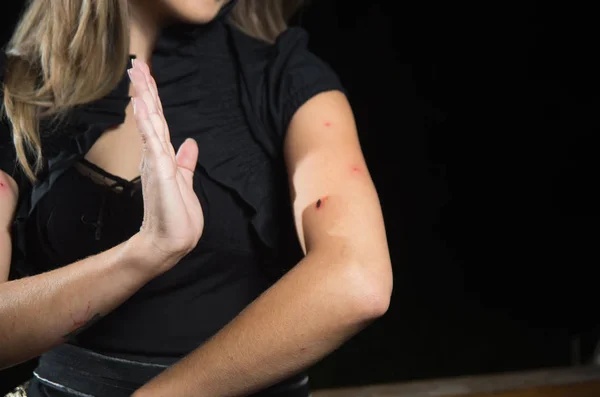 Close up de jovem que sofre de coceira após picadas de mosquito. Dermatologia, conceito de tratamento alérgico da pele . — Fotografia de Stock