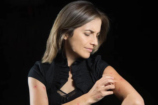 Młoda kobieta cierpi świąd po ukąszenia komara, w czarnym tle — Zdjęcie stockowe