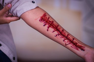 Kolunu kanama, bulanık bir arka plan ile bir genç depresif kadın yakın çekim