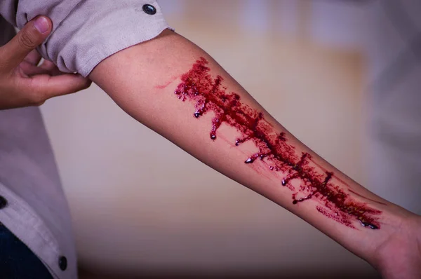 Tett inntil en ung, depressiv kvinne med blødning i armen, i uskarp bakgrunn – stockfoto