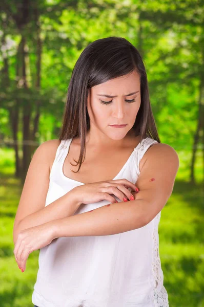 Close up de jovem que sofre de coceira após picadas de mosquito, em um fundo borrado — Fotografia de Stock