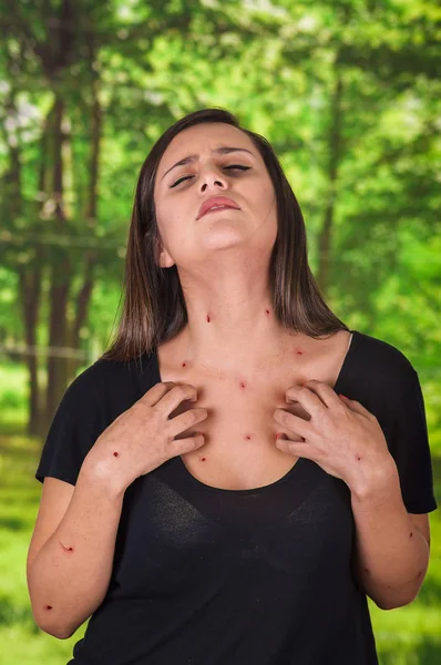 Młoda kobieta na sobie czarną bluzkę i cierpiących na swędzenie po ukąszenia komara, niewyraźne tło zielony — Zdjęcie stockowe