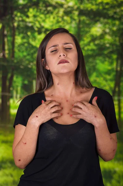 Mujer joven que lleva una blusa negra y sufre de picazón después de picaduras de mosquitos, en un fondo verde borroso — Foto de Stock