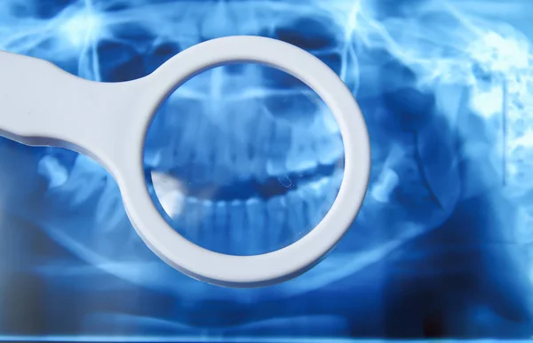 Закрытие вида рентгеновского изображения структуры зубов, медицинская концепция — стоковое фото