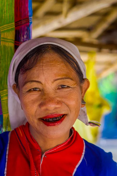 Chiang Rai, Thaiföld - február 01, 2018: Close up azonosítatlan nő mosolyogva a szörnyű fogak tartozik egy Karen hosszú nyak hill tribe falu Kayan Lahwi, Karen nő a hagyományos viseletek — Stock Fotó