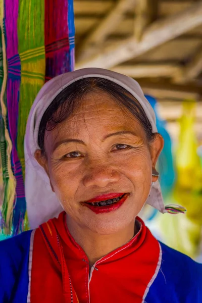 Chiang Rai, Thaiföld - február 01, 2018: Close up azonosítatlan nő mosolyogva a szörnyű fogak tartozik egy Karen hosszú nyak hill tribe falu Kayan Lahwi, Karen nő a hagyományos viseletek — Stock Fotó