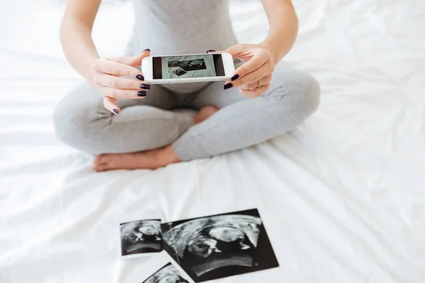 Беременная женщина фотографирует ультразвуковые снимки с помощью мобильного телефона — стоковое фото