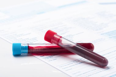 Coronavirus COVID-19 için hastaların kan örneklerini test ediyorum. Doktor Masasında Kan Numunesi içeren Test Tüpü.