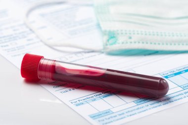 Coronavirus COVID-19 için hastaların kan örneklerini test ediyorum. Doktor Masasında Kan Numunesi içeren Test Tüpü.