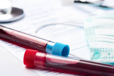 Wuhan, Çin kökenli Yeni Hızlı Yayılan Coronavirüs için Kan Test Tüpü.