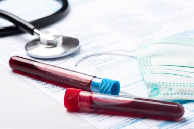 Coronavirus COVID-19 için hastaların kan örneklerini test ediyorum. Doktor Masasında Kan Numunesi içeren Test Tüpü.