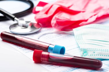Coronavirus 'un varlığı için kan testi örnekleri (COVID-19) Hastanın kan örneğini içeren tüp.