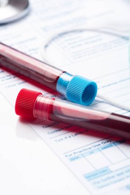 Wuhan, Çin kökenli Yeni Hızlı Yayılan Coronavirüs için Kan Test Tüpü.