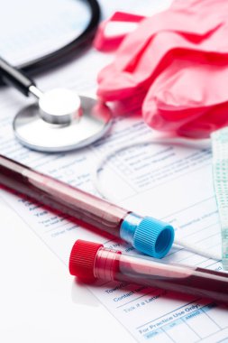 Coronavirus COVID-19 için hastaların kan örneklerini test ediyorum. Doktor Masasında Kan Numunesi içeren Test Tüpü.