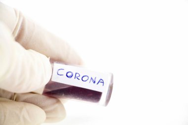 Korona virüsü için yapılan kan testi parlıyor. 