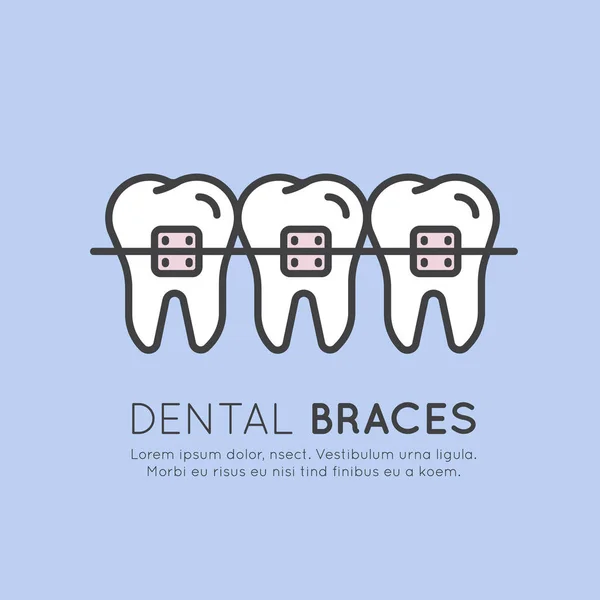 Ilustração Logo Badge ou Dental Dental Braces Instalação — Vetor de Stock