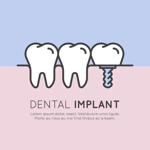 Insigne de logo ou installation d'implant dentaire — Image vectorielle