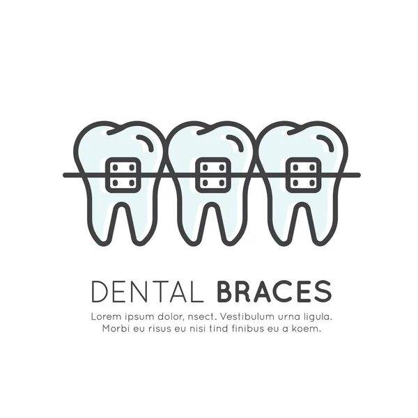 Dental Dental Braces processo de instalação — Vetor de Stock