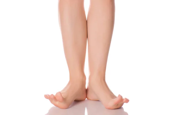 Weibliche Füße Ferse Schönheit Medizin — Stockfoto