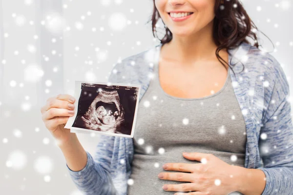 Close up of pregnant woman with ultrasound image — Stock Photo, Image