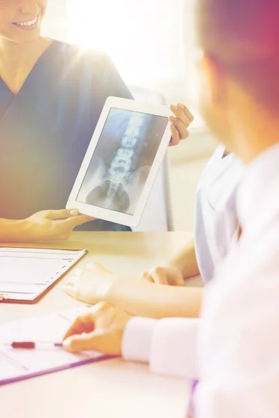 Primo piano di medici felici con radiografie in ospedale — Foto Stock