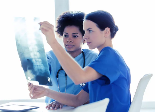 Doctors with x-ray image of spine at hospital — Stock Photo, Image