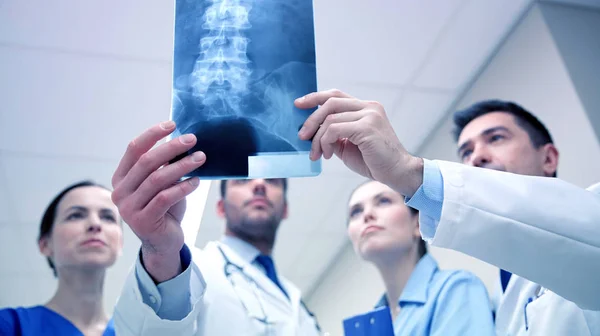 Groep van Medici met het aftasten van de röntgenfoto van de wervelkolom in ziekenhuis — Stockfoto