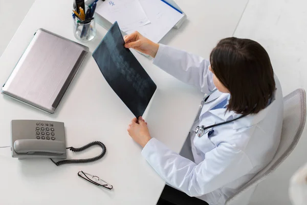 Arzt mit Röntgenbild der Wirbelsäule sitzt am Tisch — Stockfoto