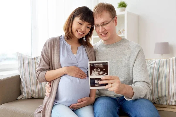 Happy couple with ultrasound images at home — Stock Photo, Image