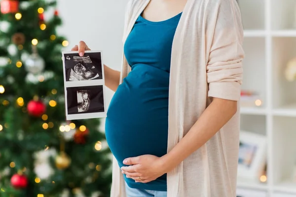 Zwangere vrouw met echografie beelden met Kerstmis — Stockfoto