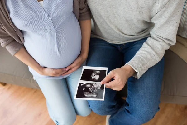 Primer plano de pareja con imágenes de ultrasonido de bebé —  Fotos de Stock