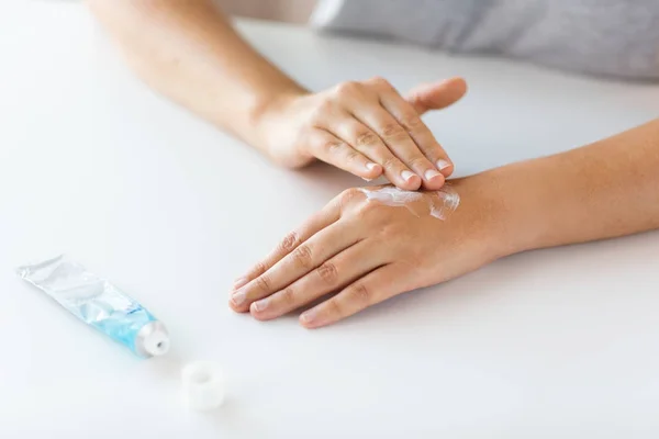 Primo piano delle mani con crema o unguento terapeutico — Foto Stock