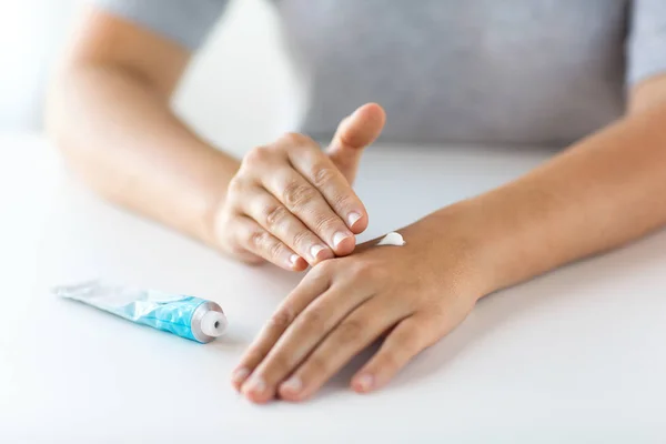 Nahaufnahme der Hände mit Creme oder therapeutischer Salbe — Stockfoto