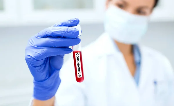 Scientist holding test tube with coronavirus — Stock Fotó